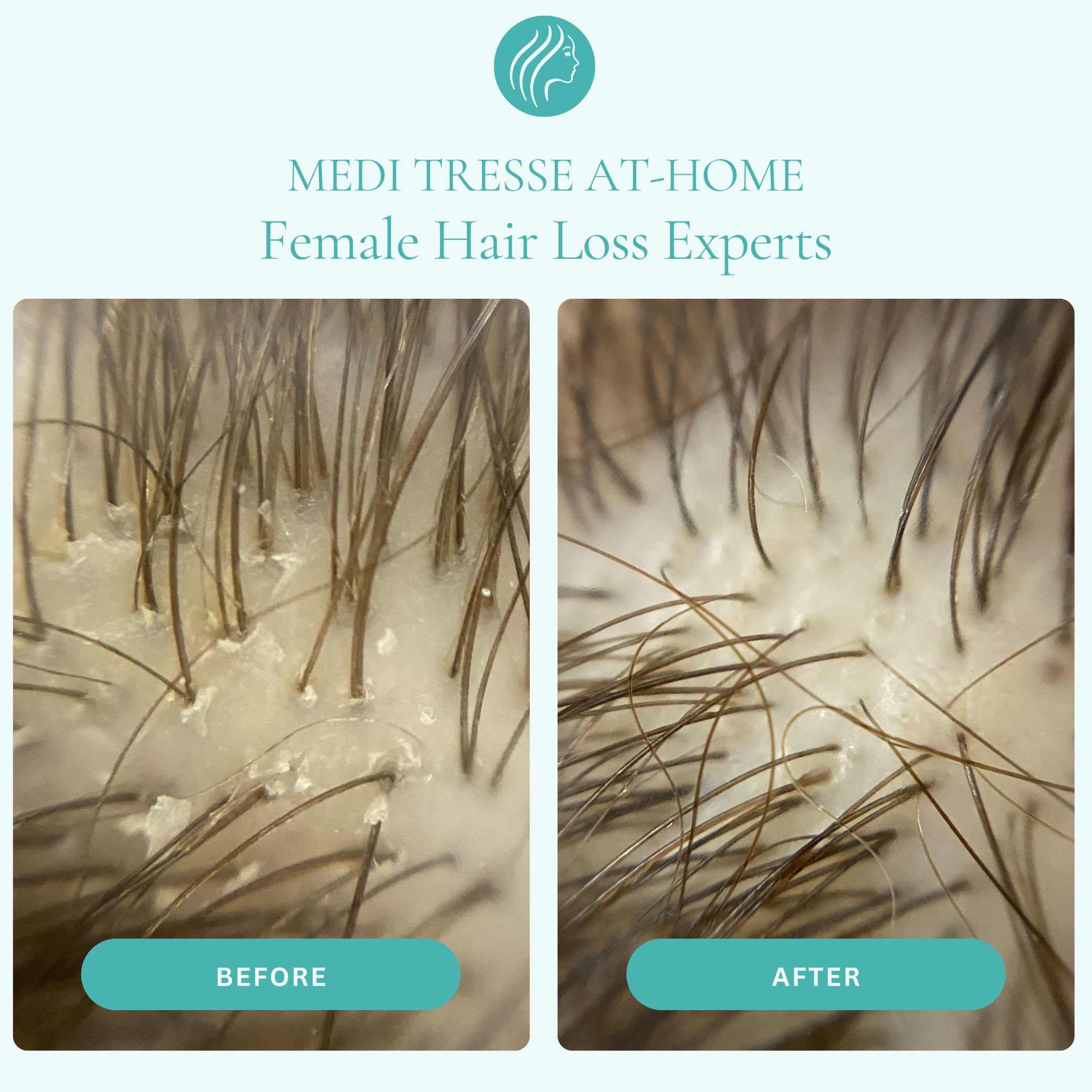 Scalp Root Cleanse Shampoo – Medi Tresse At-home